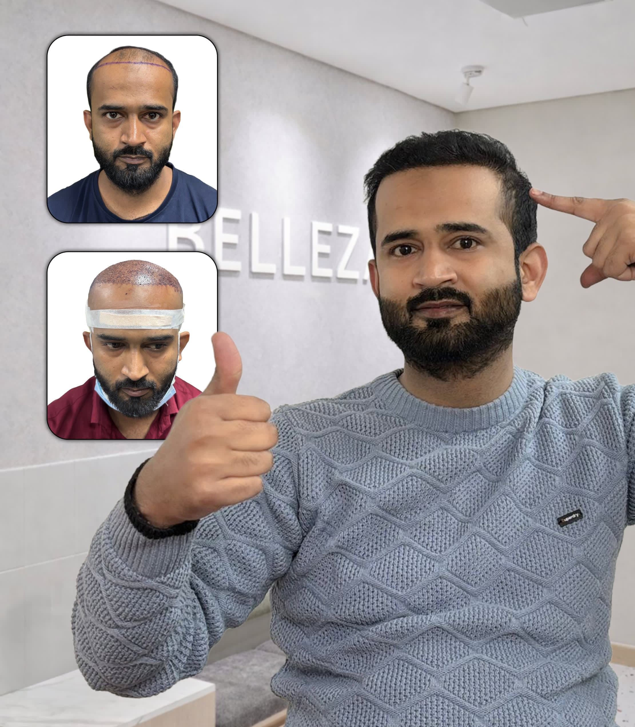 Restoring Hair, Renewing Confidence