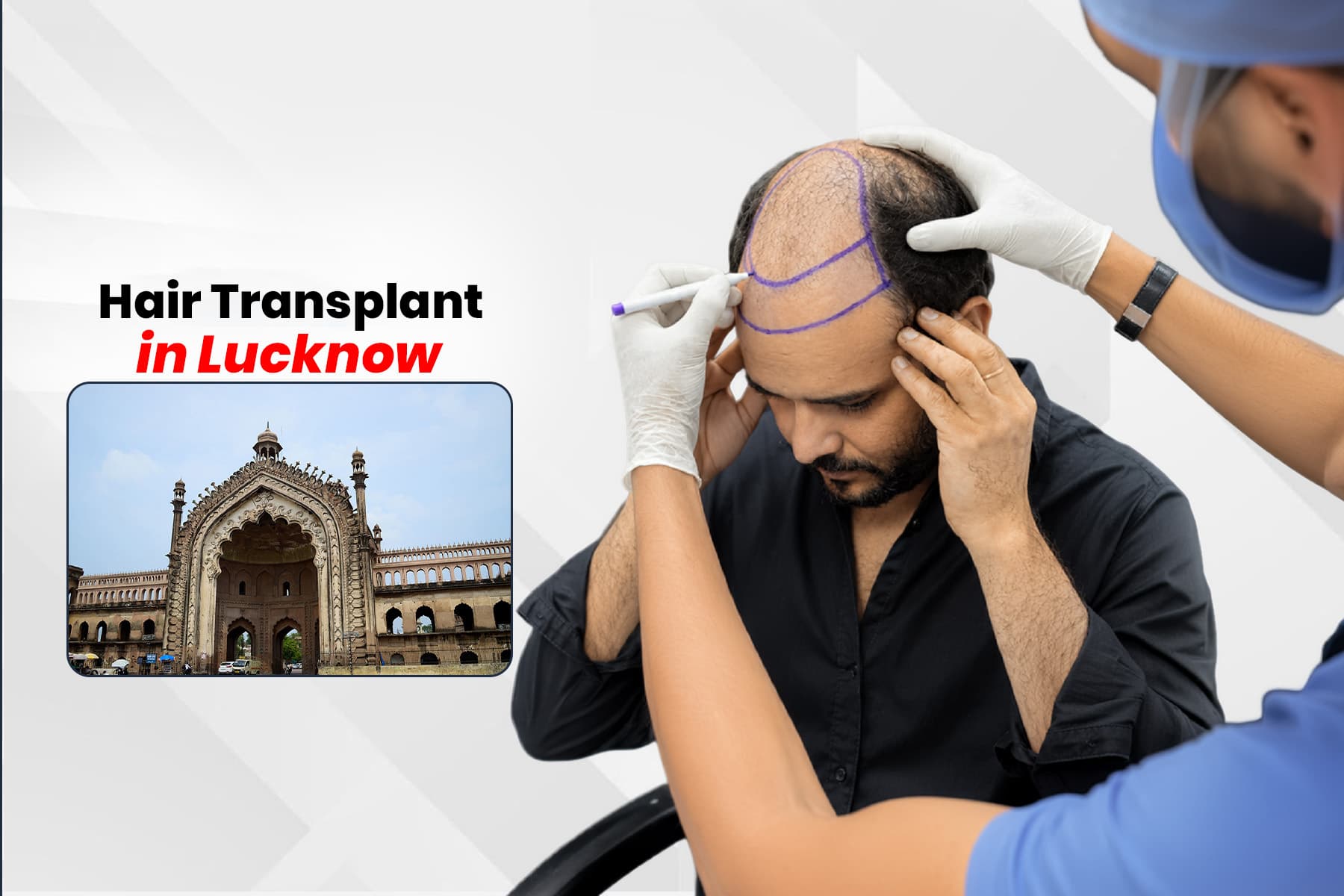 Hair Transplant Clinic in Lucknow | FUE & DHI Specialists